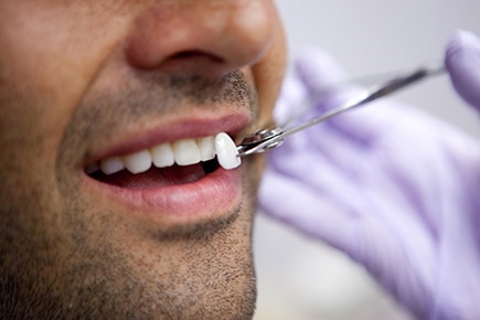 Lente dental em Poços de Caldas