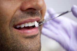 Lente dental em Lorena